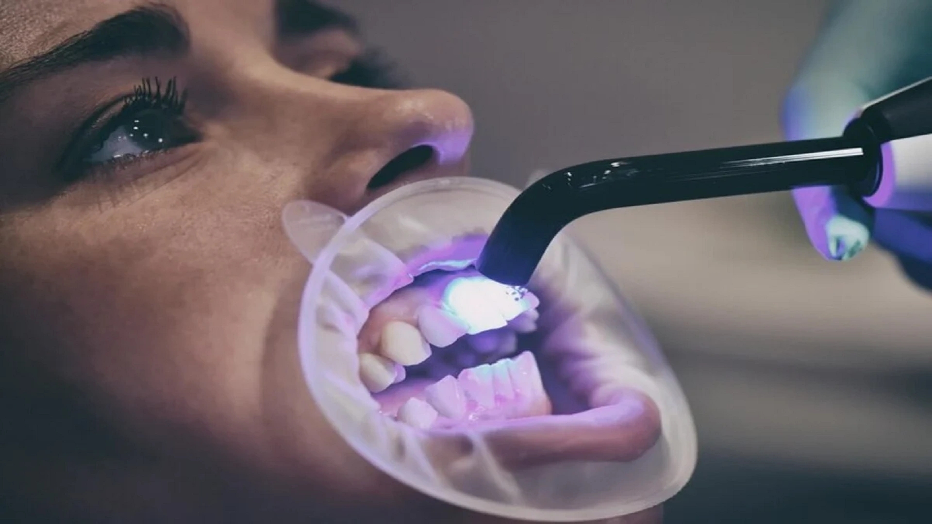 Biomimetic Dentistry