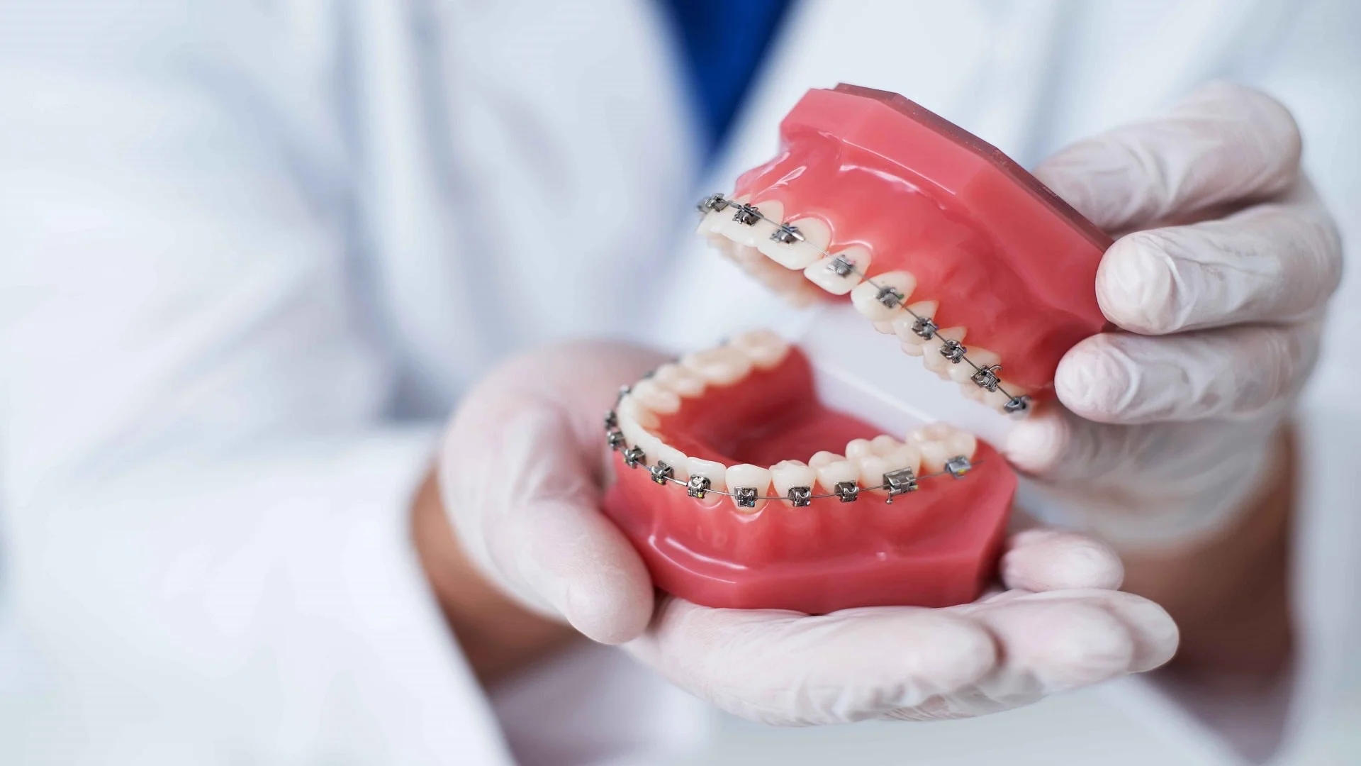 Dental orthodontics