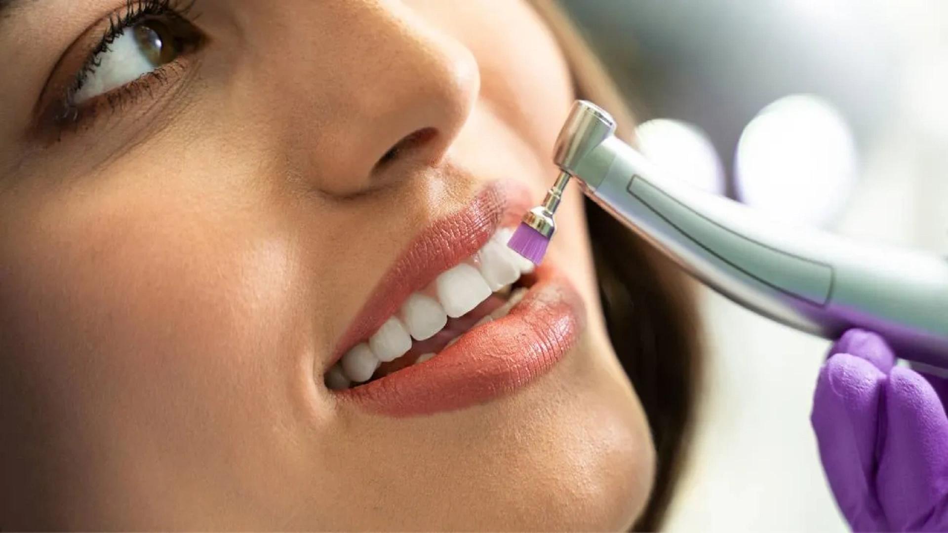 Does Teeth Scaling Damage Your Teeth? A Scientific Review of the Risks