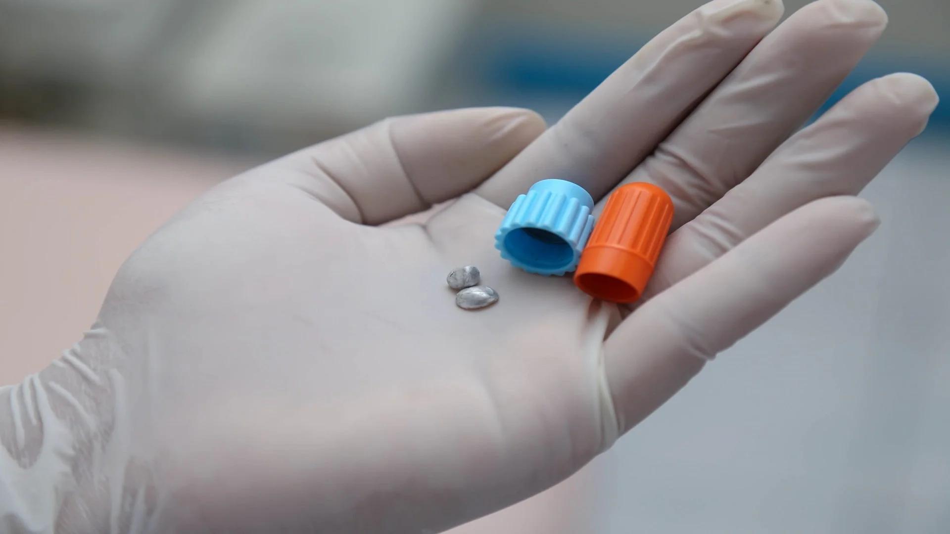 What is Amalgam? A Review of Its Advantages, Disadvantages, and Comparison with Composite