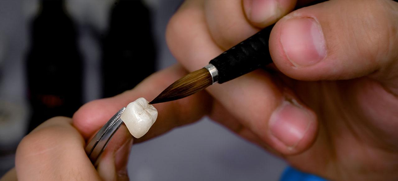 Dental Implant