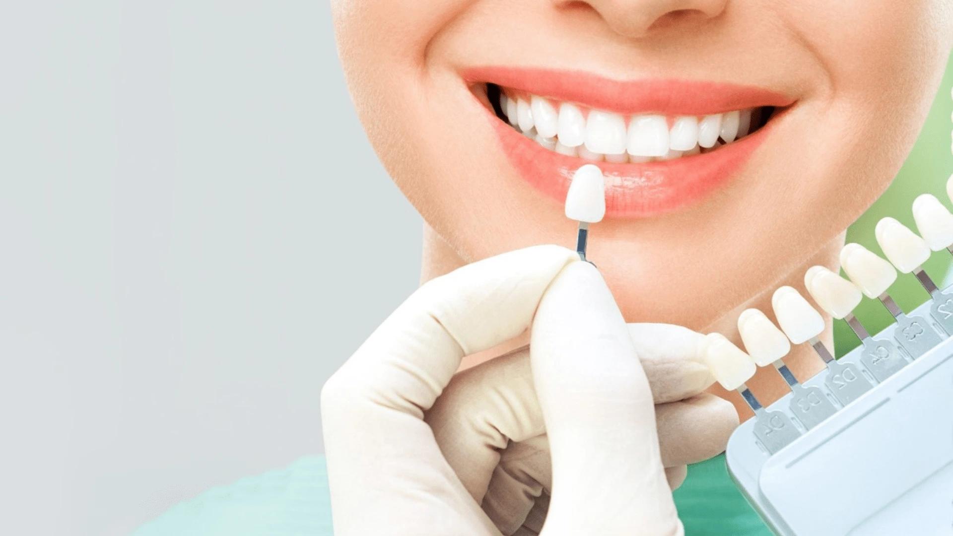 Dental composite