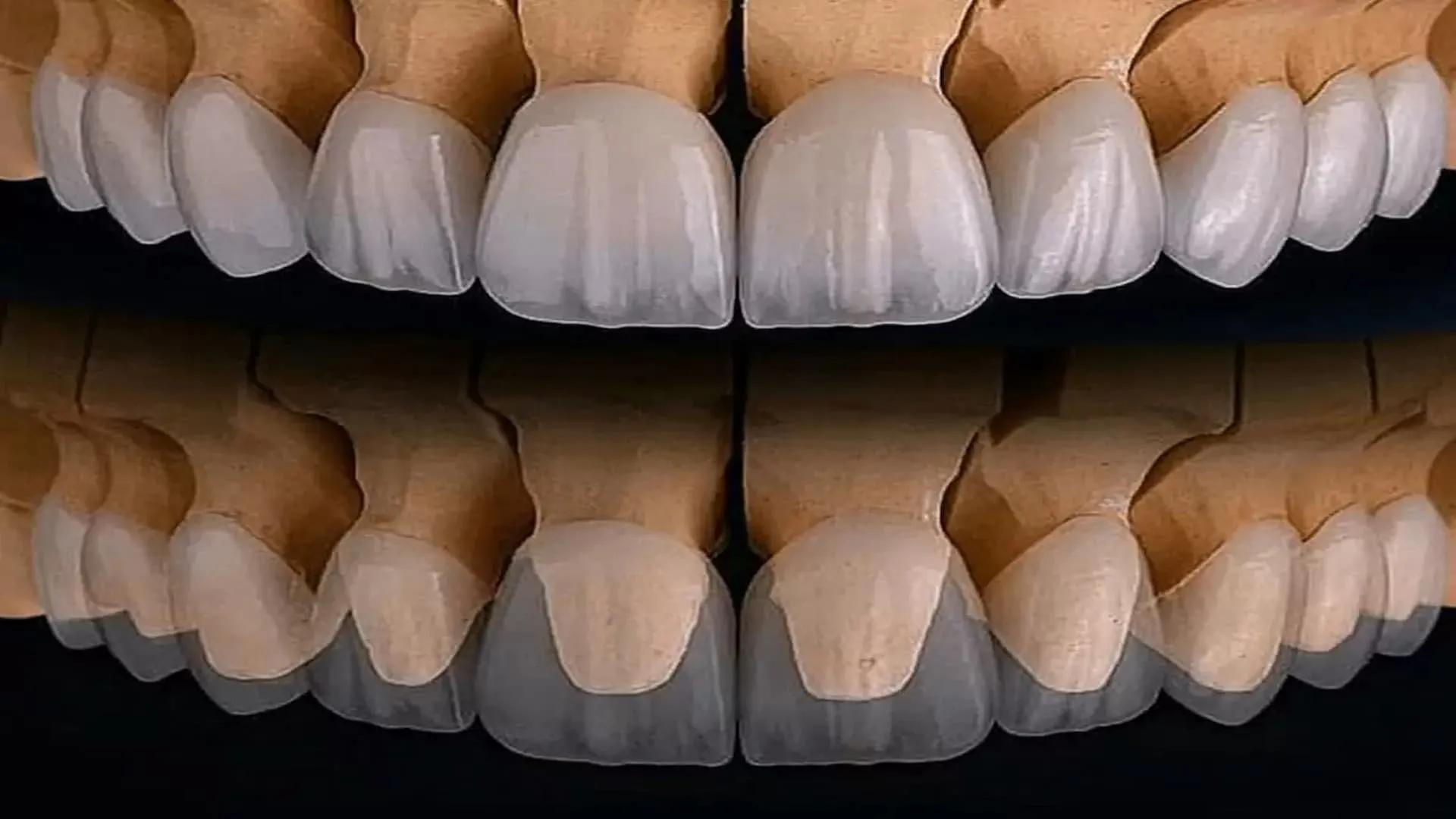 What is zirconia coating and what are its advantages and disadvantages