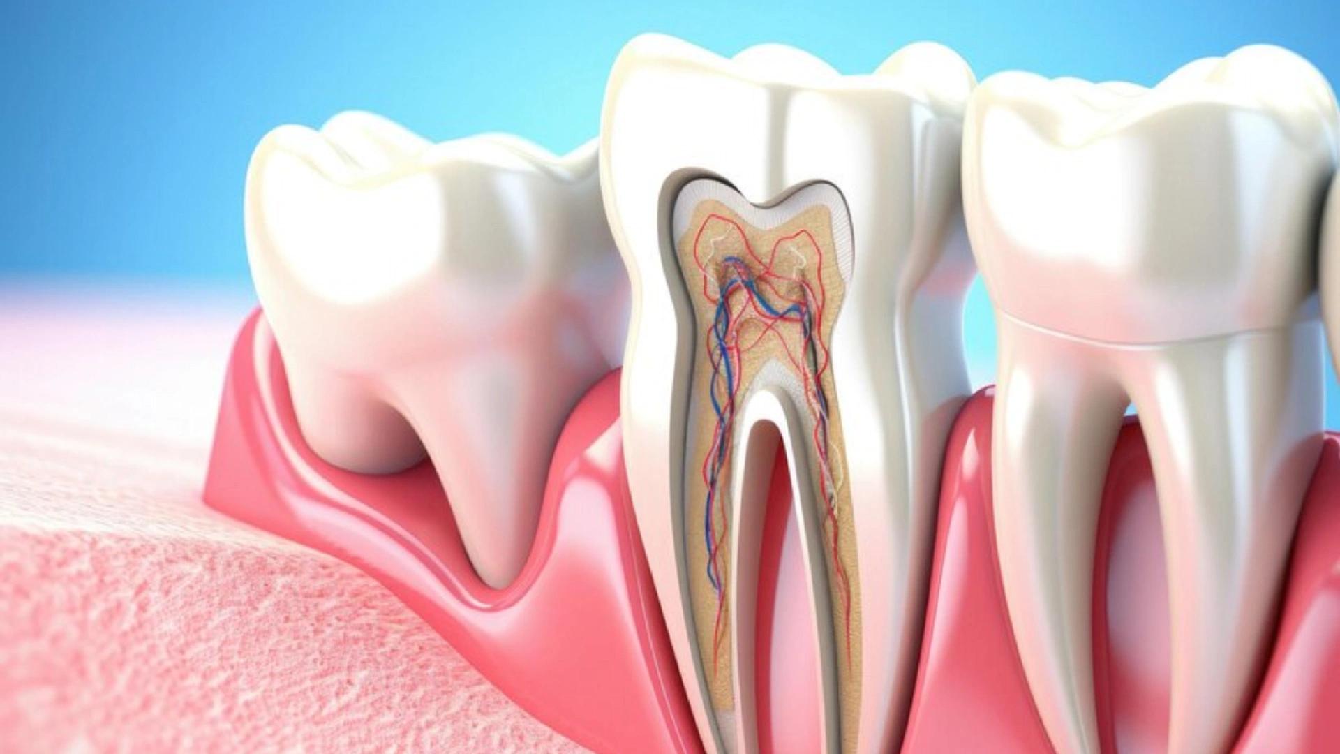 Take Dental Infections Seriously: Symptoms to Treatment