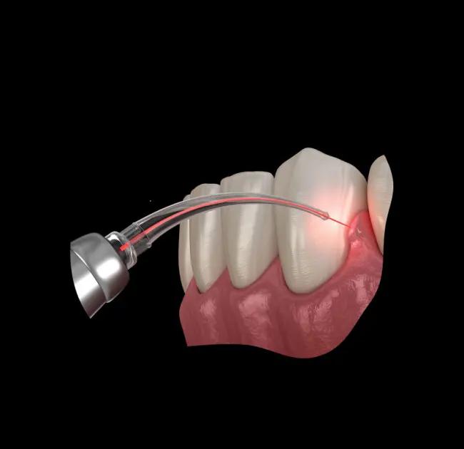 کیس آزمایشی