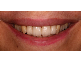 Minimal Treatments - Maximal Achievements 1