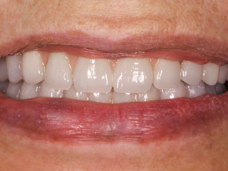 Minimal Treatments - Maximal Achievements 1