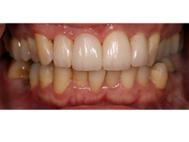 Minimal Treatments - Maximal Achievements 3